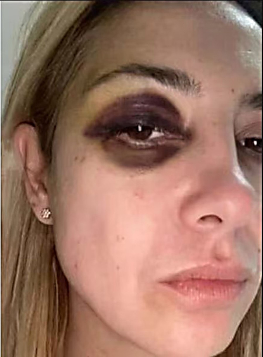 Fabiola Ya&ntilde;ez denunci&oacute; a Alberto Fern&aacute;ndez por violencia de g&eacute;nero.