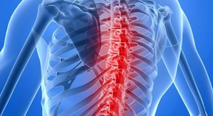 La AME es una de las enfermedades neuromusculares sist&eacute;micas m&aacute;s graves.