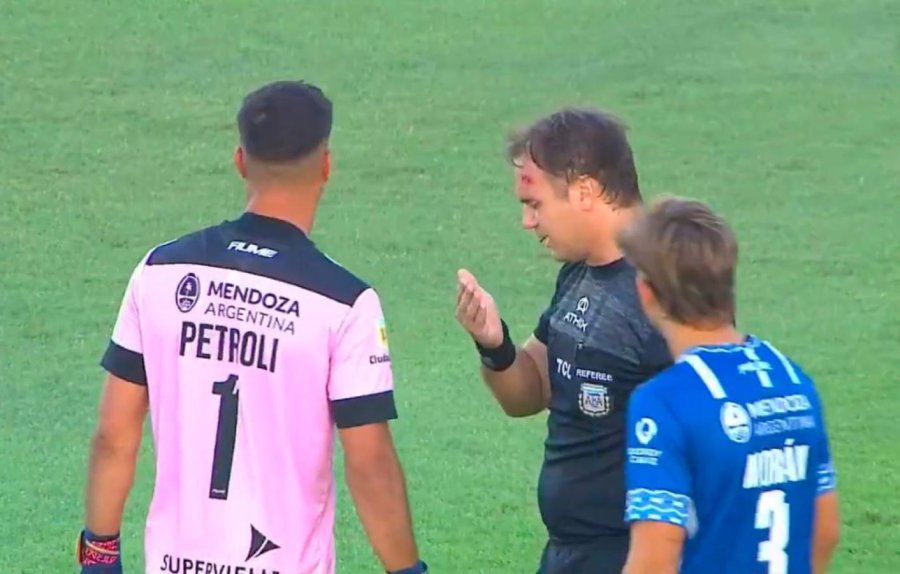 El árbitro asistente Diego Martín, recibió un proyectil en su cabeza.