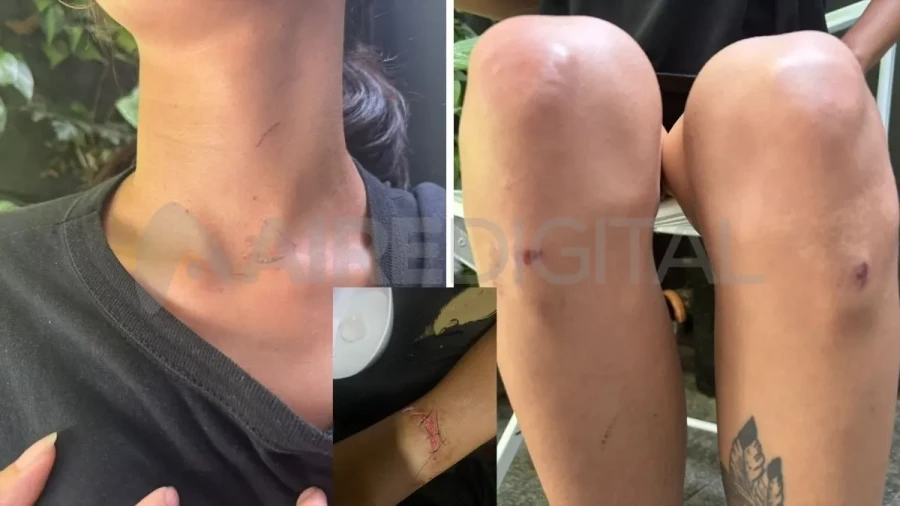 LA VÍCTIMA. Una muestra de lo experimentado.