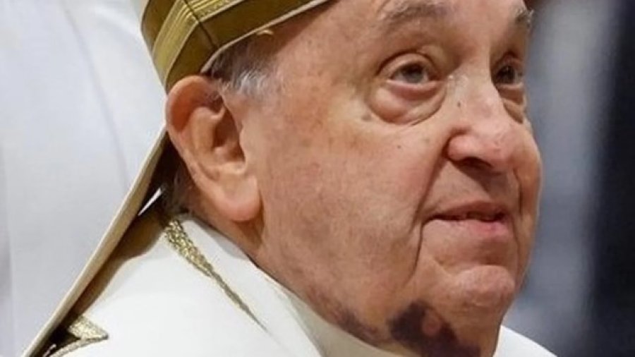 SIGUE INTERNADO. El líder de la iglesia católica permanece en estado crítico y preocupa su insuficiencia renal.