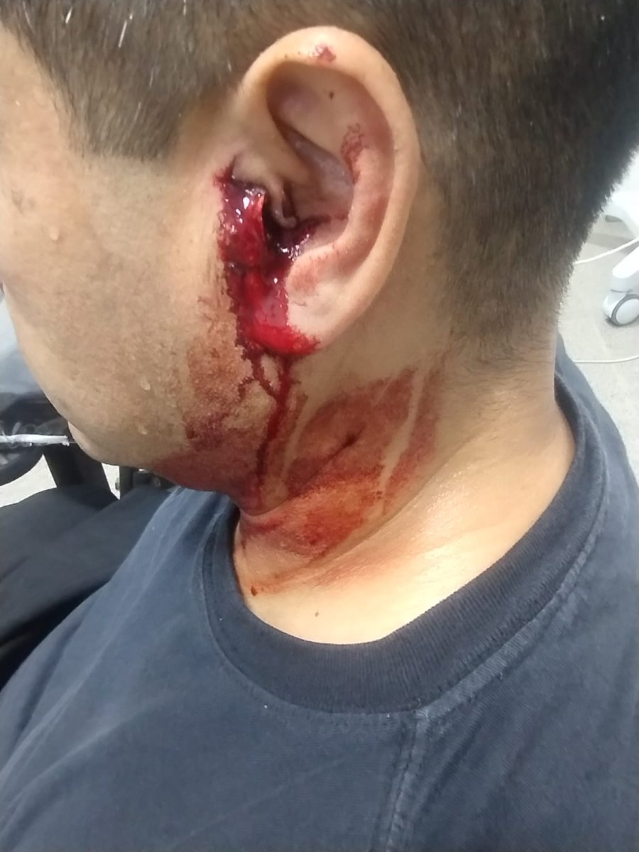 El subjefe del Comando Radioeléctrico inspector Carlos Javier Zapata, fue alcanzado por un proyectil en el oído por lo que fue trasladado al Hospital “Jaime Ferré”.