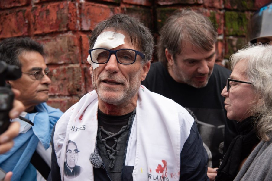 El Padre Olveira sufrió una herida durante la represión a la marcha de jubilados y organizaciones políticas y sociales.