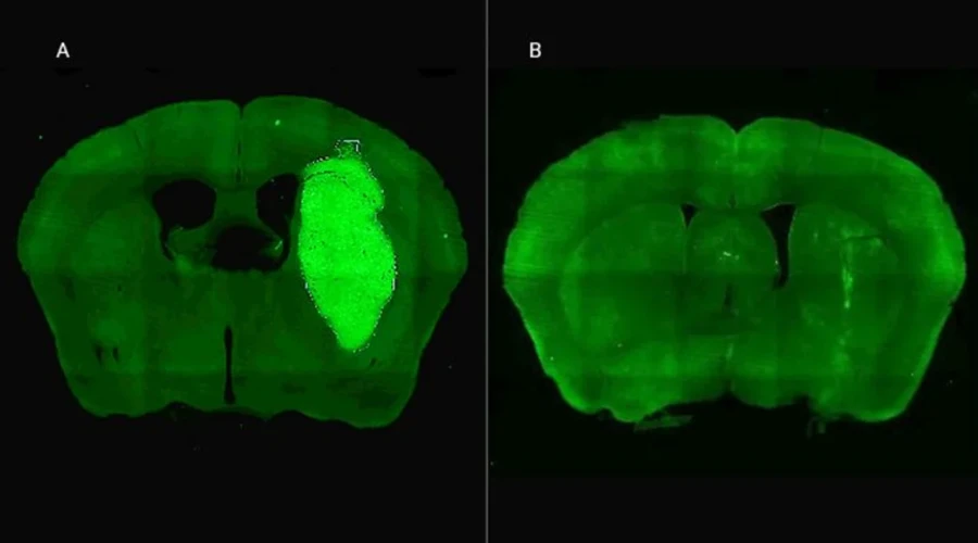 A) Se visualiza el tumor cerebral en un modelo preclínico. B) El tumor desaparece gracias a la administración de la estrategia terapéutica diseñada por los especialistas del CONICET.