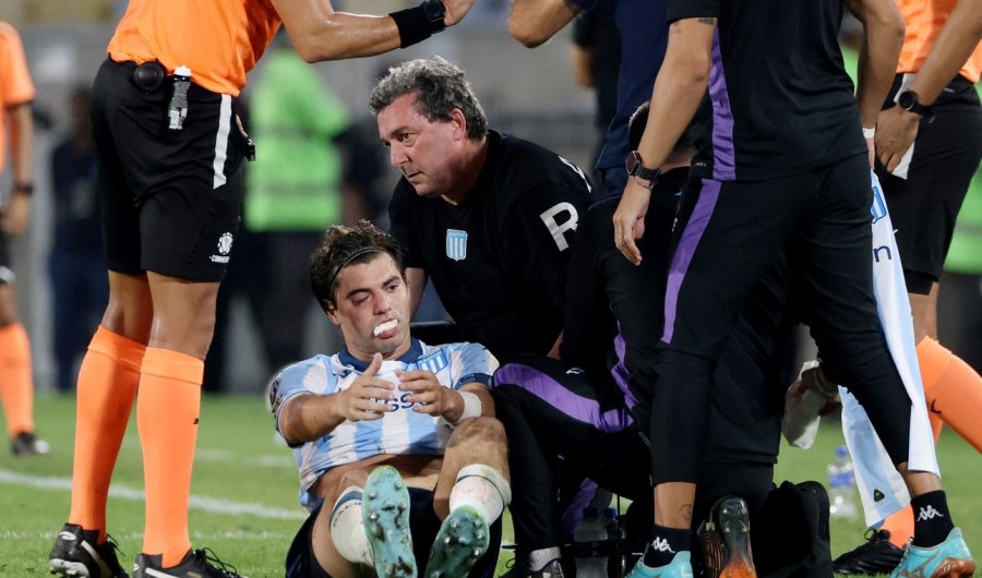 TREMENDO IMPACTO. Seguramente tendrá que ser operado.