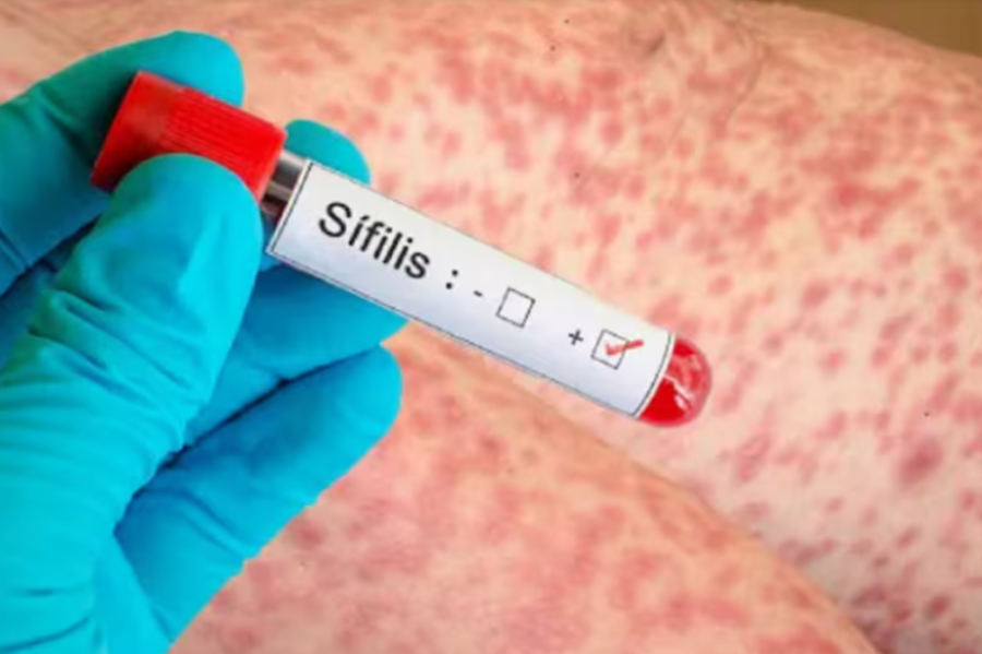 AUMENTAN LOS CASOS. La sífilis, la enfermedad de transmisión sexual que atormenta a una generación que le escapa al preservativo.