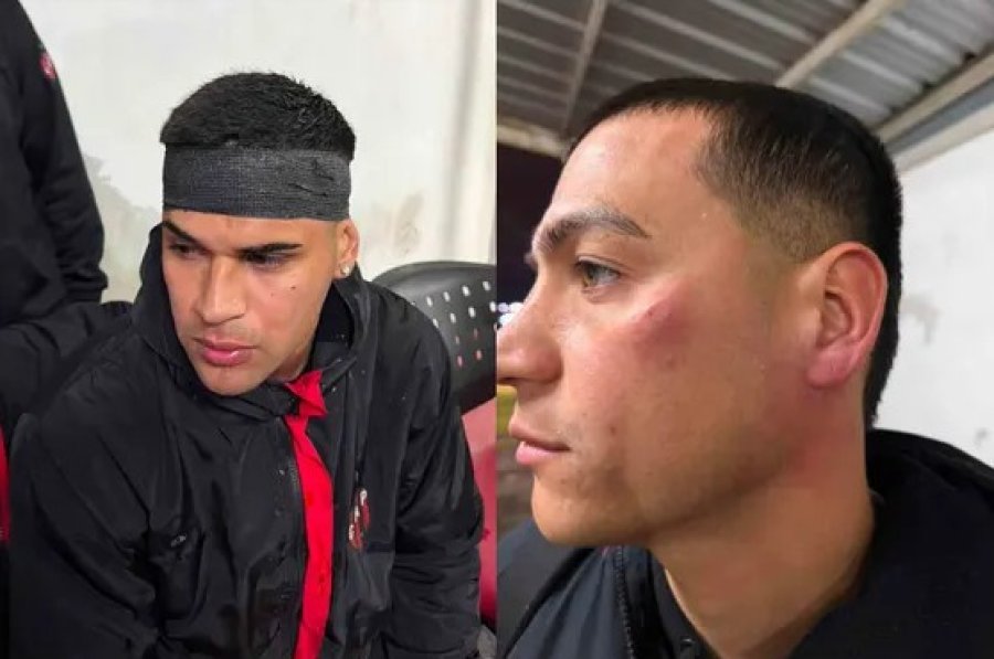 AFECTADOS. Sosa y D&iacute;az, los jugadores que mostraron las agresiones.
